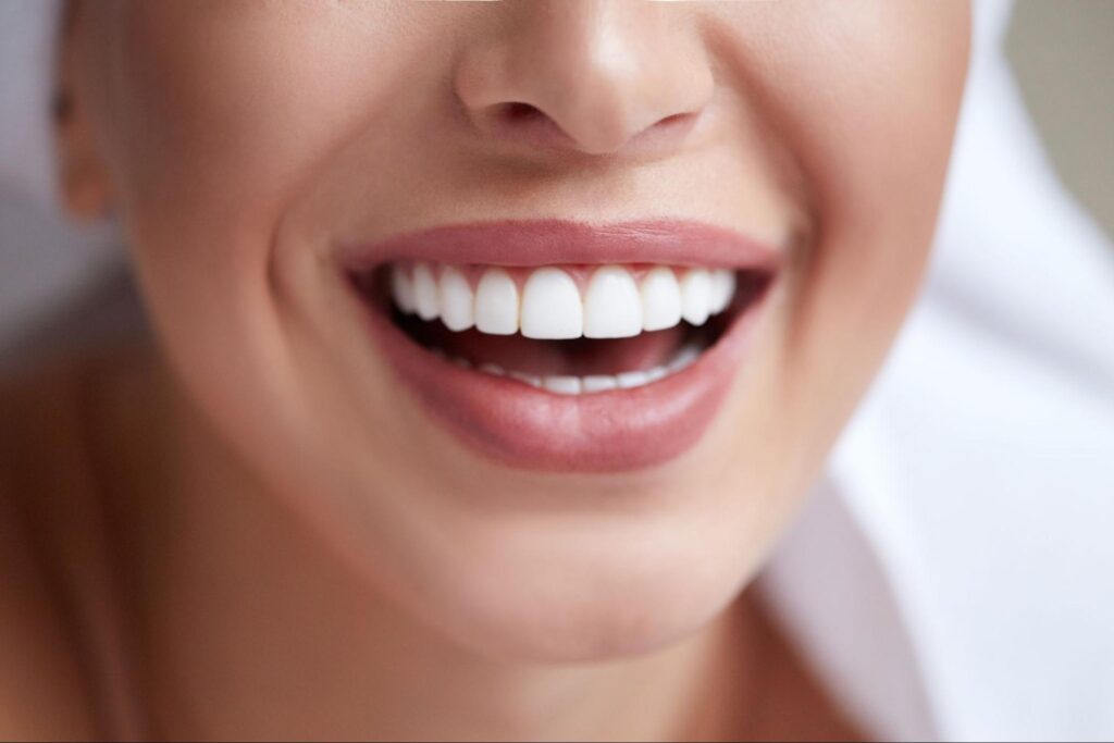 Tips To Achieve A Brighter Smile With Teeth Whitening