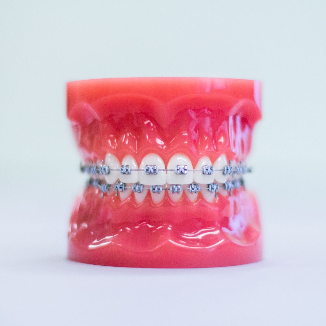omaha braces for kids